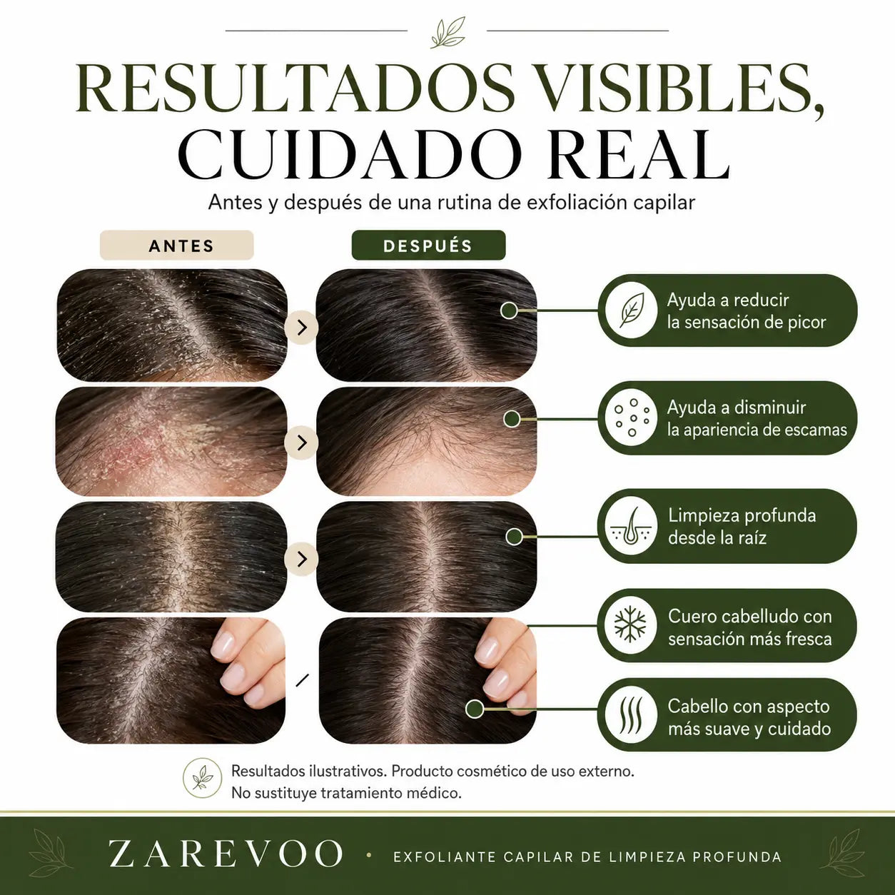 Exfoliante Capilar de Limpieza Profunda — Zarevoo