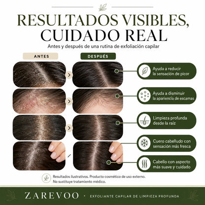 Exfoliante Capilar de Limpieza Profunda — Zarevoo