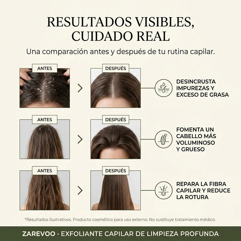 Exfoliante Capilar de Limpieza Profunda - Zarevoo